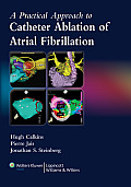 Practical Approach to Catheter Ablation of Atrial Fibrillation
