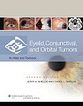Eyelid, Conjunctival, and Orbital Tumors: An Atlas and Text