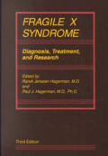 Fragile X Syndrome: Diagnosis, Treatment, and Research