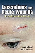 Lacerations & Acute Wounds