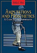 Amputations & Prosthetics A Case Study Approach