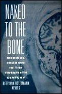 Naked to the Bone Medical Imaging in the Twentieth Century