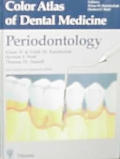 Periodontology 2nd Edition Color Atlas of Dental Medicine 1