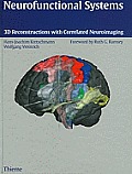 Neurofunctional Systems 3d Reconstruct