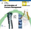 Principles of Fracture Management