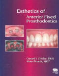 Esthetics Of Anterior Fixed Prosthodonti