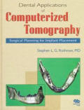 Dental Applications of Computerized Tomography: Surgical Planning for Implant Placement