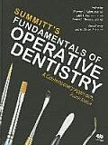 Summitt's Fundamentals of Operative Dentistry: A Contemporary Approach