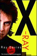 X Ray Kinks