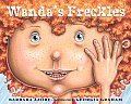 Wandas Freckles