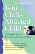 Your Cleft Affected Child