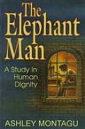 Elephant Man A Study In Human Dignity