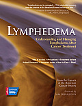 Lymphedema Understanding & Managing Lymphedema After Cancer Treatment