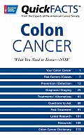 Quick Facts On Colon Cancer
