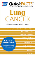 Quick Facts Lung Cancer What You Need to Know Now