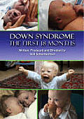 Down Syndrome: The First 18 Months