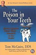 Poison in Your Teeth Mercury Amalgam Silver Fillings Hazardous to Your Health