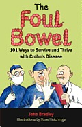 The Foul Bowel: 101 Ways to Survive and Thrive With Crohn's Disease