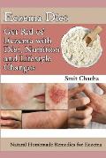 Eczema Diet - Get Rid of Eczema with Diet, Nutrition and Lifestyle Changes: Natural Homemade Remedies for Eczema
