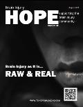 Brain Injury Hope Magazine - August 2019