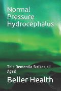 2019 Normal Pressure Hydrocephalus: This Dementia Strikes all Ages!