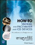 How-To Manual for Pacemaker and ICD Devices: Procedures and Programming