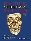 Fractures of the Facial Skeleton