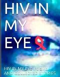HIV in my Eye