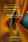 What You Need to Know About Melanoma and Other Skin Cancers