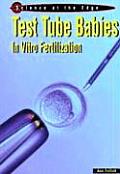 Test Tube Babies In Vitro Fertilization
