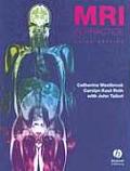 Mri In Practice 3rd Edition
