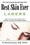 The Ultimate Guide for the Best Skin Ever: Lasers