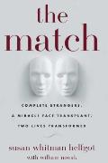 Match: Complete Strangers, a Miracle Face Transplant, Two Lives Transformed