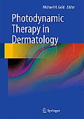 Photodynamic Therapy in Dermatology