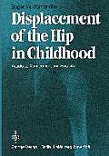 Displacement of the Hip in Childhood: Aetiology, Management and Sequelae