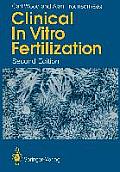 Clinical in Vitro Fertilization