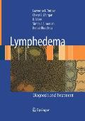 Lymphedema: Diagnosis and Treatment