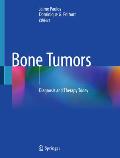 Bone Tumors: Diagnosis and Therapy Today