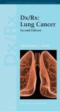 DX/Rx: Lung Cancer: Lung Cancer