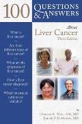 100 Q&as about Liver Cancer 3e