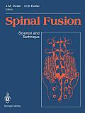 Spinal Fusion: Science and Technique