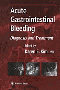 Acute Gastrointestinal Bleeding: Diagnosis and Treatment