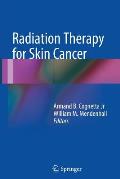 Radiation Therapy for Skin Cancer