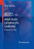 Adult Acute Lymphocytic Leukemia: Biology and Treatment