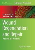 Wound Regeneration and Repair: Methods and Protocols