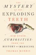 Mystery of the Exploding Teeth & Other Curiosities from the History of Medicine