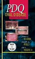 PDQ Oral Disease: Diagnosis and Treatment