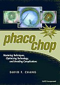 Phaco Chop