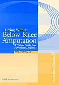 Living With A Below Knee Amputation A Un