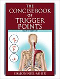 Concise Book of Trigger Points Revised